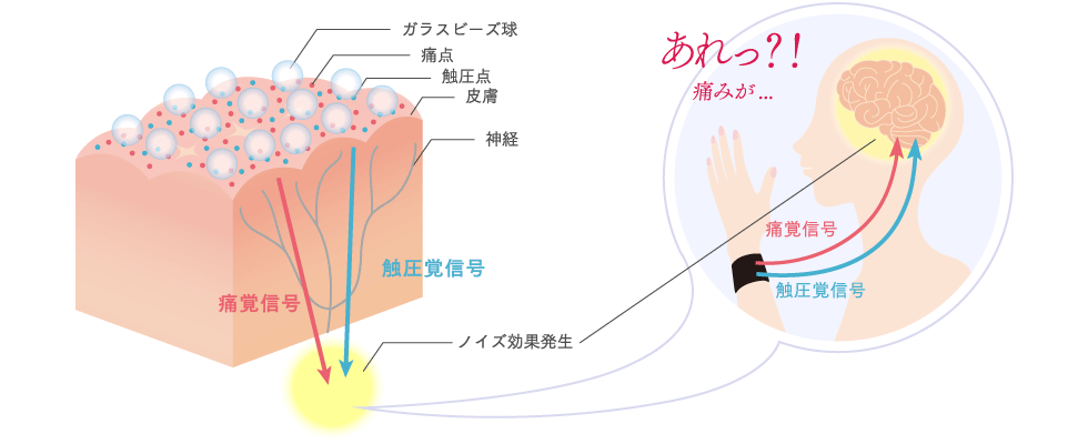 メカニズム